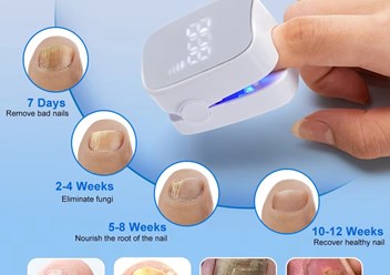 Лампа от грибка ногтей NAIL FUNGUS LASER DEVICE