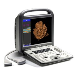 Ультразвуковой сканер S8