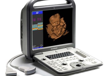 Ультразвуковой сканер S8