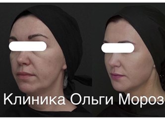 Фото компании ООО Морозов 2