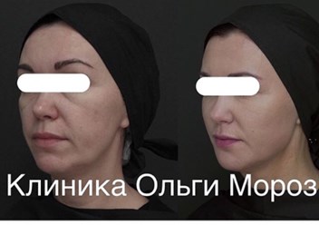 Фото компании ООО Морозов 2