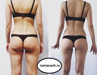 Фото компании ИП Массаж в Краснодаре 9