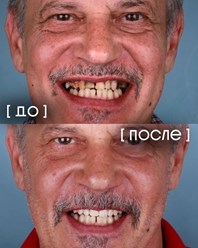 Фото компании  Экспертная стоматология «Элисан» 28