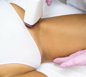 Лазерная эпиляция бикини