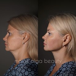 Фото компании ООО Морозов 1