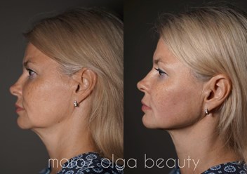 Фото компании ООО Морозов 1