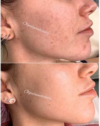 Фото компании  OlgailyinaBeauty 4