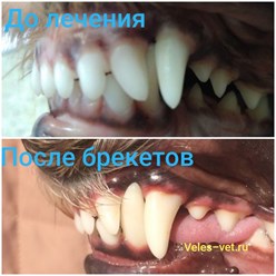 Как выглядят зубы после исправления прикуса