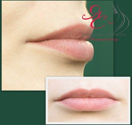 Зажившая работа, перед коррекцией.
Очень удобно в жизни. 👍
Не нужно переживать, что сейчас с лицом... 😊
Готовы подать себе красоту?
Ваша Светлана Яковенко
#нюдовыегубкиОренбург #липлайтгубыоренбург