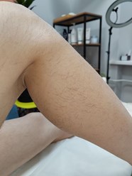 Фото компании ООО Epil 20