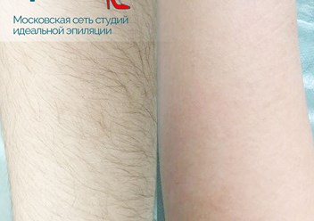 Фото компании ООО Epil bar 1
