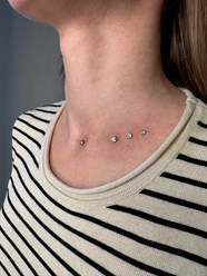 Микродермал в Калинграде