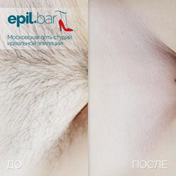 Фото компании ООО Epil bar 16