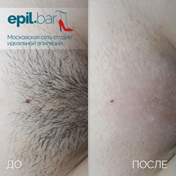 Фото компании ООО Epil bar 6