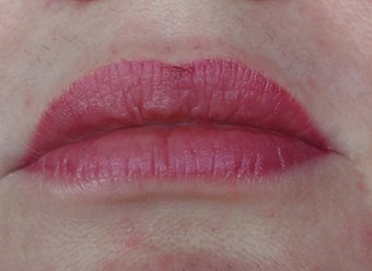 Зажившая работа, перед коррекцией.
Очень удобно в жизни. 👍
Не нужно переживать, что сейчас с лицом... 😊
Готовы подать себе красоту?
Ваша Светлана Яковенко
#нюдовыегубкиОренбург #липлайтгубыоренбург