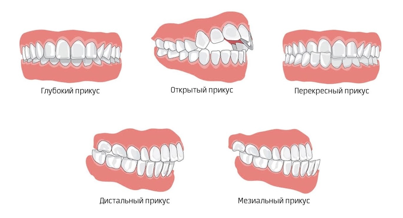 Диадент Петрозаводск - телефон, адрес, контакты. Отзывы о Диадент ( Петрозаводск), вакансии