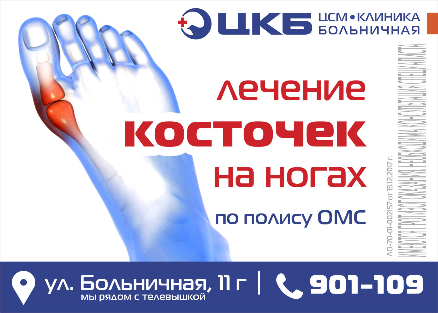 Операция лазером по омс. Операция косточек на ногах по ОМС. Удалить косточку на ноге в Москве по полису ОМС. Удаление косточки на ноге по полису ОМС. Удаление косточек на ногах в Москве по полису ОМС.